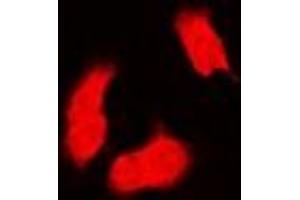 Image no. 1 for anti-Proteasome (Prosome, Macropain) Subunit, beta Type, 9 (Large Multifunctional Peptidase 2) (PSMB9) antibody (ABIN2966947)