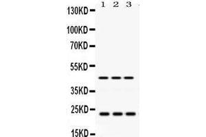 Western Blotting (WB) image for anti-RAB13, Member RAS Oncogene Family (RAB13) (AA 121-150), (C-Term) antibody (ABIN3043916)