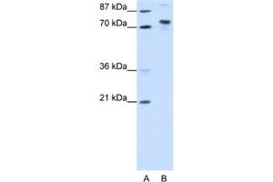 Image no. 1 for anti-TOX High Mobility Group Box Family Member 4 (TOX4) antibody (ABIN2461858)