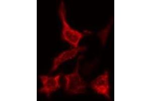 Image no. 4 for anti-Catalase (CAT) antibody (ABIN6260491)