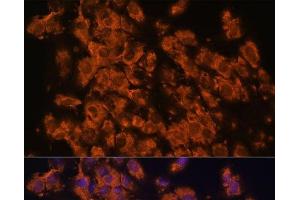 Immunofluorescence analysis of C6 cells using LRRC7 Polyclonal Antibody at dilution of 1:100.
