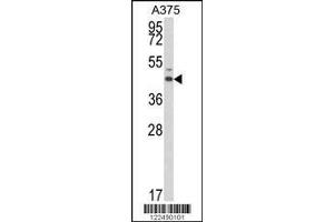 Western Blotting (WB) image for anti-Estrogen-Related Receptor alpha (ESRRA) antibody (ABIN2158744)