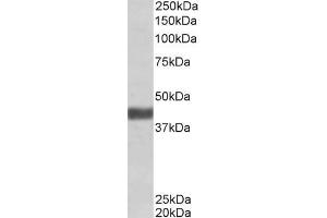 Image no. 1 for anti-F-Box Protein 32 (FBXO32) (Internal Region) antibody (ABIN570946)
