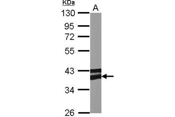 Adiponectin Receptor 1 anticorps  (C-Term)
