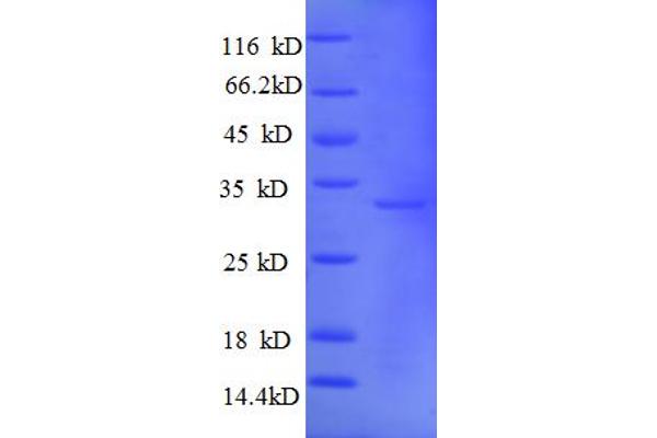 MT1A Protein (AA 1-59, partial) (GST tag)