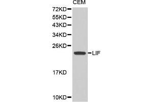 Western blot analysis of extracts of CEM cell line, using LIF antibody.