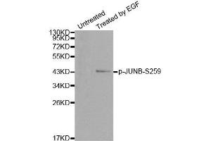 Image no. 1 for anti-Jun B Proto-Oncogene (JUNB) (pSer259) antibody (ABIN3020277)