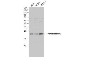 WB Image Peroxiredoxin 2 antibody detects Peroxiredoxin 2 protein by western blot analysis.