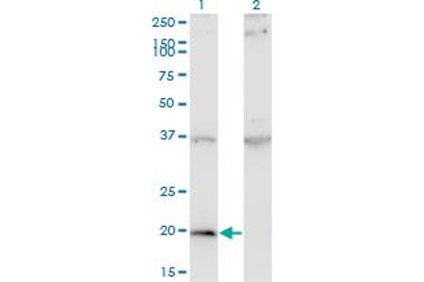 anti-Interferon, alpha 1 (IFNA1) (AA 24-133) antibody