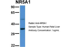 Image no. 4 for anti-Nuclear Receptor Subfamily 5, Group A, Member 1 (NR5A1) (Middle Region) antibody (ABIN2777447)