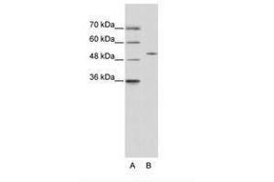 Image no. 2 for anti-Zinc Finger Protein 555 (ZNF555) (AA 128-177) antibody (ABIN6736215)