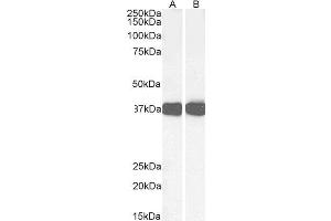 Image no. 3 for anti-Arginase, Liver (ARG1) (C-Term) antibody (ABIN190828)