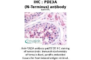 Image no. 1 for anti-phosphodiesterase 3A, cGMP-Inhibited (PDE3A) (N-Term) antibody (ABIN1737913)