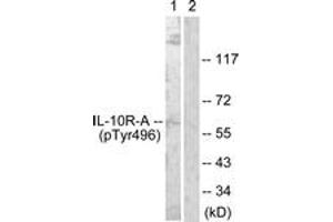 Western blot analysis of extracts from HuvEc cells, using IL-10R alpha (Phospho-Tyr496) Antibody.
