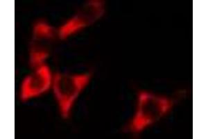 Image no. 1 for anti-B-Cell Receptor-Associated Protein 31 (BCAP31) antibody (ABIN6257952)
