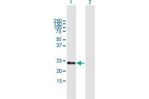 Western Blot analysis of STARD5 expression in transfected 293T cell line by STARD5 MaxPab polyclonal antibody.