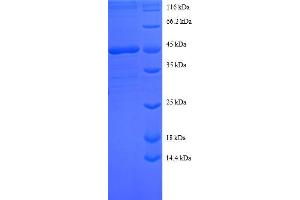Sorting Nexin 3 Protein (SNX3) (AA 3-162, full length) (GST tag)