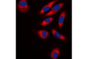 Image no. 3 for anti-TNF Receptor-Associated Factor 3 Interacting Protein 1 (TRAF3IP1) (Center) antibody (ABIN2707195)