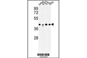 Western Blotting (WB) image for anti-Calcium Activated Nucleotidase 1 (CANT1) antibody (ABIN2158035)