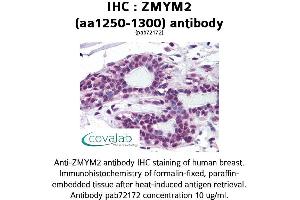 Image no. 1 for anti-Zinc Finger, MYM-Type 2 (ZMYM2) (AA 1250-1300) antibody (ABIN1740931)
