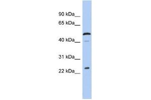 Image no. 1 for anti-Chromosome 1 Open Reading Frame 190 (C1orf190) (Middle Region) antibody (ABIN2786572)