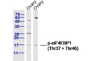 Image no. 5 for anti-Eukaryotic Translation Initiation Factor 4E Binding Protein 1 (EIF4EBP1) (pThr37), (pThr46) antibody (ABIN682978)