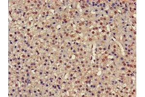 PSMC4 antibody  (Regulatory Subunit 6B)