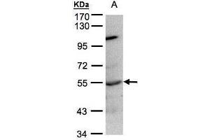 Image no. 2 for anti-Protein tyrosine Phosphatase, Non-Receptor Type 1 (PTPN1) (Center) antibody (ABIN2856256)