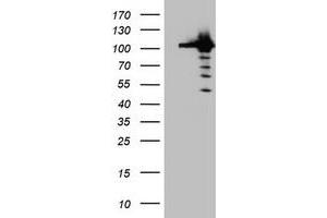 Image no. 4 for anti-Cullin 4B (CUL4B) (AA 1-300) antibody (ABIN1490724)