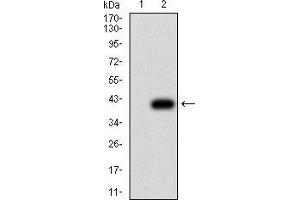 anti-Thrombospondin 1 (THBS1) (AA 750-850) antibody