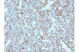 Image no. 2 for anti-CD99 (CD99) antibody (ABIN6940042)