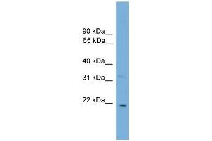 Image no. 1 for anti-Cardiotrophin 1 (CTF1) (N-Term) antibody (ABIN2784703)
