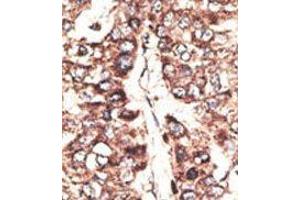 Image no. 1 for anti-Melanoma Antigen Family A, 11 (MAGEA11) (N-Term) antibody (ABIN358642)