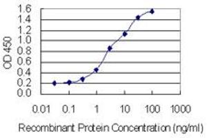 Image no. 2 for anti-Synaptonemal Complex Central Element Protein 1 (SYCE1) (AA 1-190) antibody (ABIN949790)