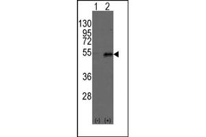 Image no. 1 for anti-Dystrobrevin Binding Protein 1 (DTNBP1) (C-Term) antibody (ABIN357846)