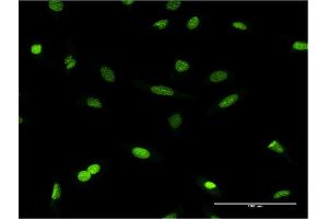Immunofluorescence of monoclonal antibody to CBX1 on HeLa cell.