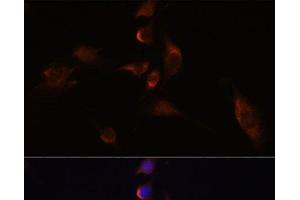 HuC/ELAVL3 anticorps