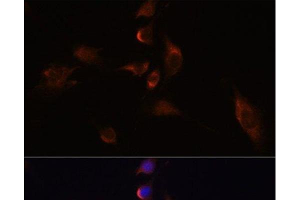 HuC/ELAVL3 anticorps
