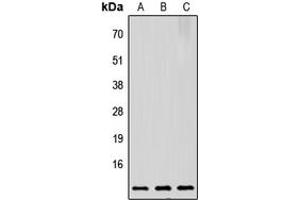 Image no. 1 for anti-Prothymosin, alpha (PTMA) (C-Term) antibody (ABIN2705158)