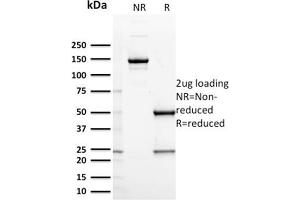 Image no. 3 for anti-Interleukin 7 Receptor (IL7R) (AA 21-236) antibody (ABIN6939786)