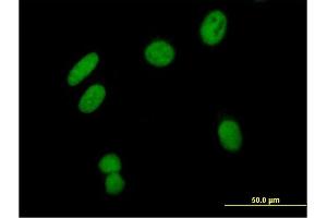 Immunofluorescence of purified MaxPab antibody to ZNF435 on HeLa cell.