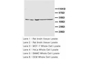 Image no. 2 for anti-Presenilin 2 (Alzheimer Disease 4) (PSEN2) (AA 319-334) antibody (ABIN1493957)