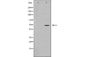 Image no. 3 for anti-Vitamin D Receptor (VDR) antibody (ABIN6265961)