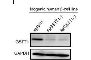 Image no. 7 for anti-Glutathione S-Transferase theta 1 (GSTT1) (full length) antibody (ABIN2856663)