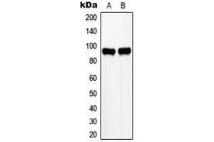 Image no. 1 for anti-Zinc Fingers and Homeoboxes 2 (ZHX2) (C-Term) antibody (ABIN2705340)