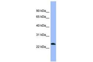 Nociceptin anticorps  (AA 107-156)