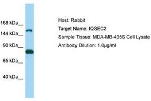 Image no. 1 for anti-IQ Motif and Sec7 Domain 2 (IQSEC2) (AA 351-400) antibody (ABIN6750202)