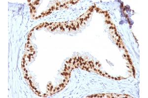Image no. 3 for anti-Forkhead Box A1 (FOXA1) (AA 372-472) antibody (ABIN6939651)