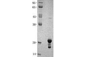 Image no. 1 for Non-Metastatic Cells 1, Protein (NM23A) Expressed in (NME1) (Transcript Variant 2) protein (His tag) (ABIN2726967)