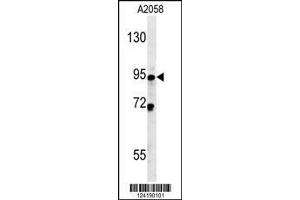Image no. 2 for anti-Sphingomyelin Phosphodiesterase 4 (SMPD4) (AA 80-108), (N-Term) antibody (ABIN652084)